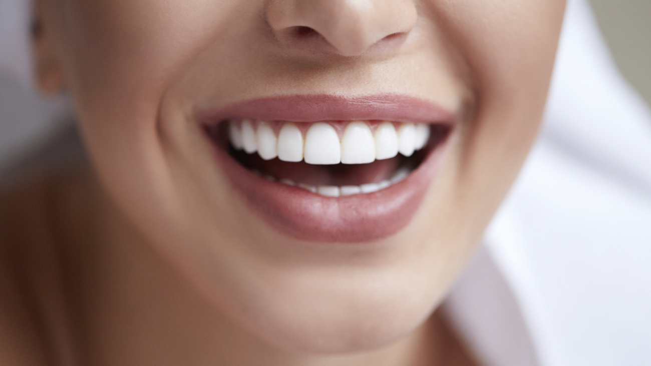 Healthy white smile close up. Beauty woman with perfect smile, lips and teeth. Beautiful Model Girl with perfect skin. Teeth whitening.