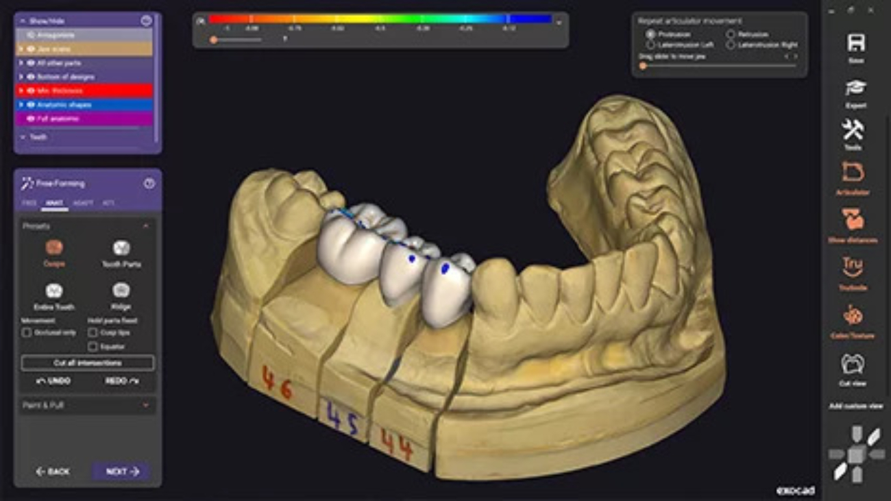exocad_dentalcad_galway_new_ui_design