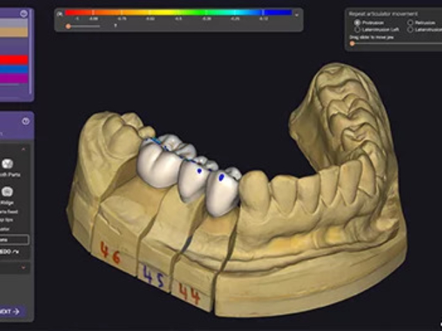 exocad_dentalcad_galway_new_ui_design