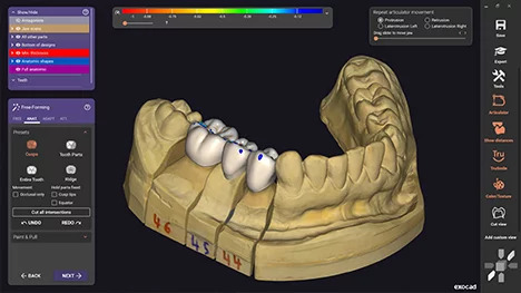 exocad_dentalcad_galway_new_ui_design