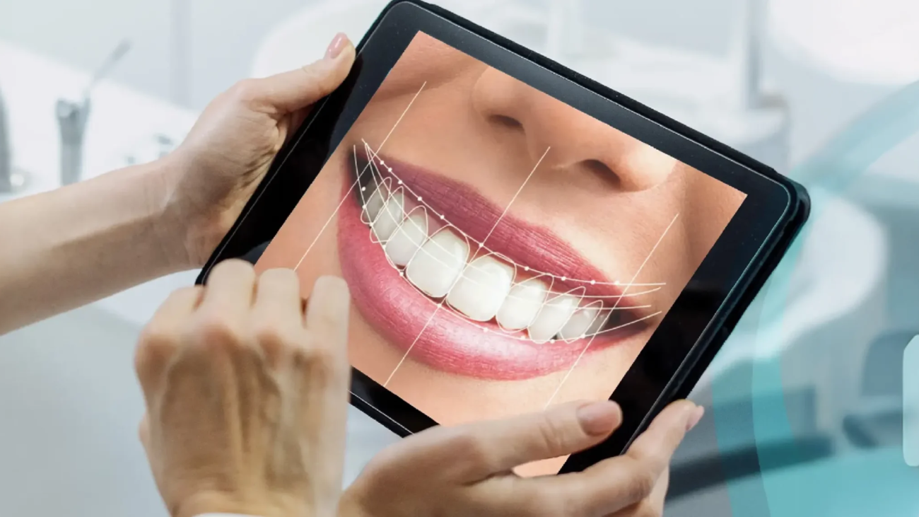 treatments-digital-smile