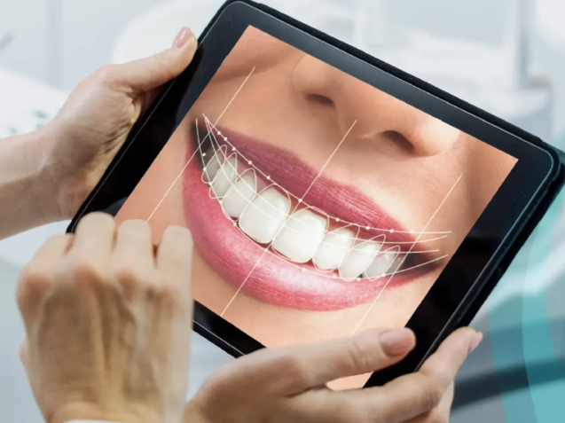 treatments-digital-smile