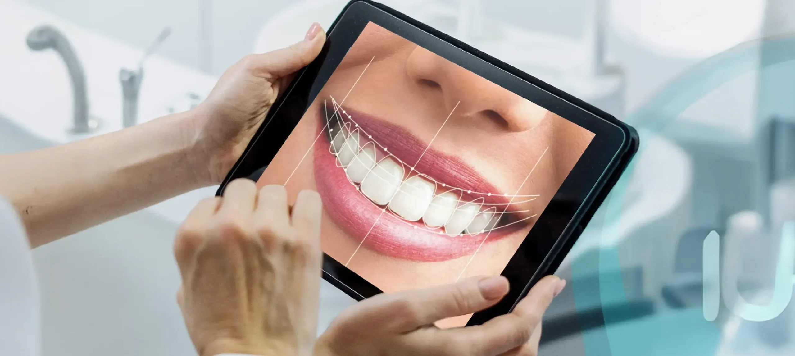 treatments-digital-smile